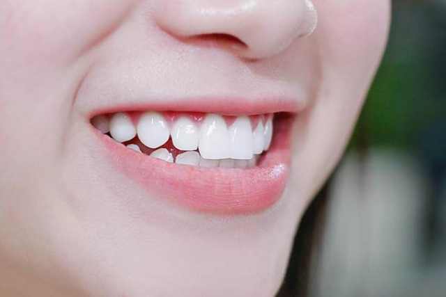 Bọc răng sứ tại Nha Khoa Alpha