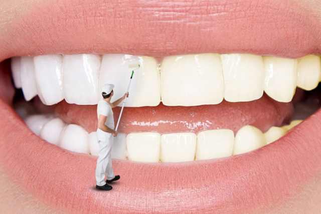 Tẩy trắng răng tại Nha Khoa Alpha