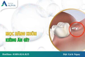 Mọc răng khôn kiêng ăn đồ gì tránh bị đau và buốt