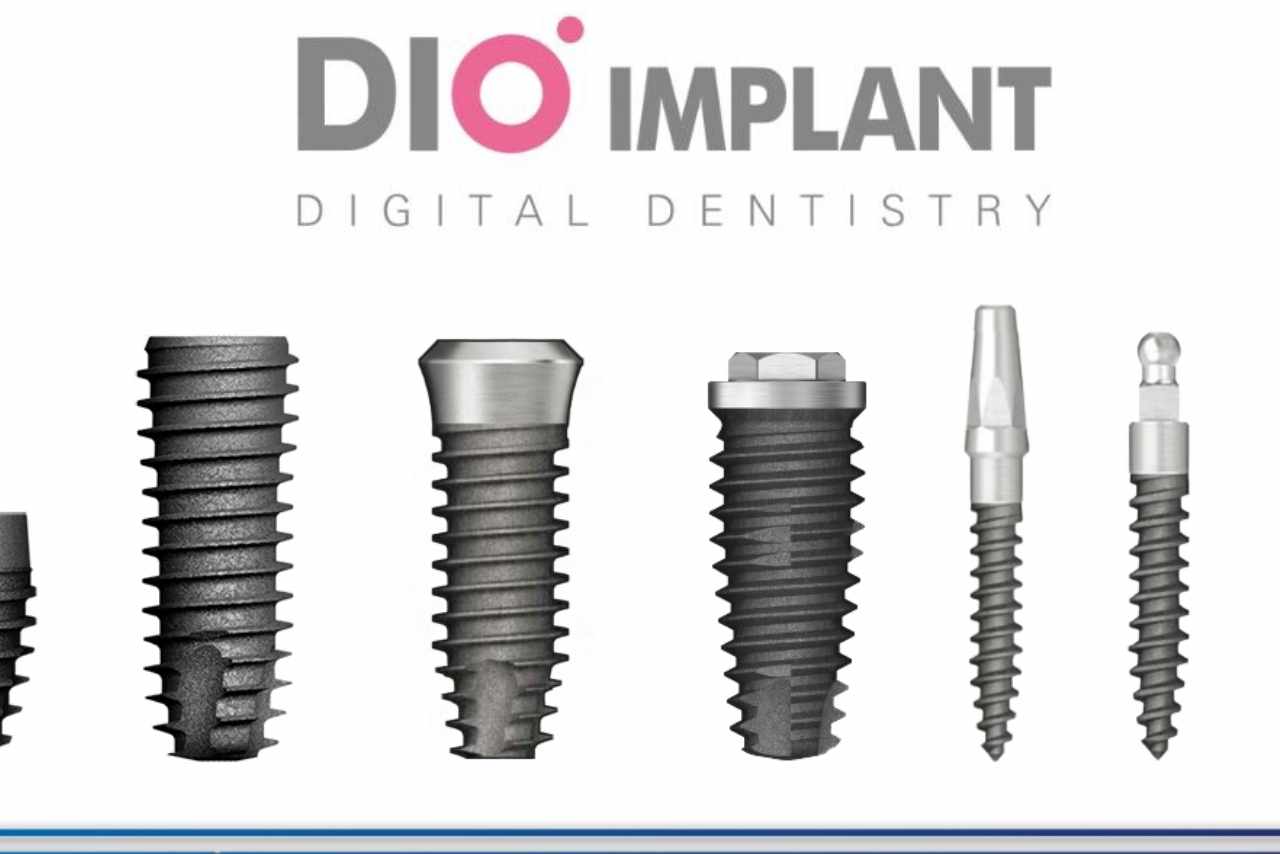 Cấy Implant Dio taij Nha Khoa Alpha
