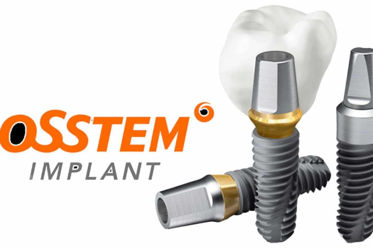 Cấy Implant OSSTEM tại Nha Khoa Alpha