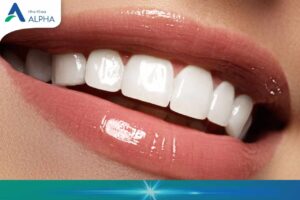 Bọc răng sứ zirconia uy tín tại Nha Khoa Alpha Hải Phòng