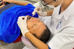 Nha Khoa Alpha là địa chỉ hàng đầu khi tìm kiếm địa chỉ lấy cao răng tại Hải Phòng