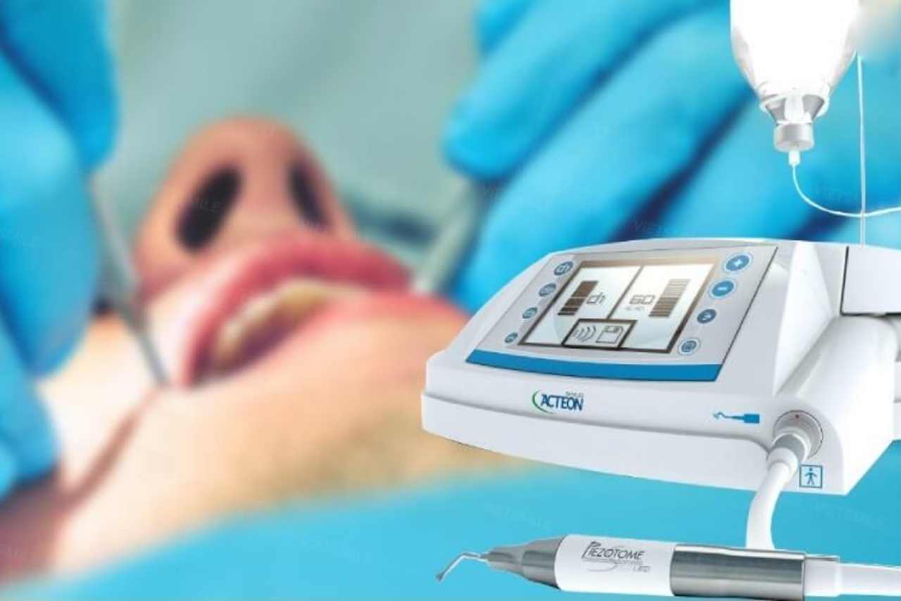 Phương pháp nhổ răng bằng Piezotome