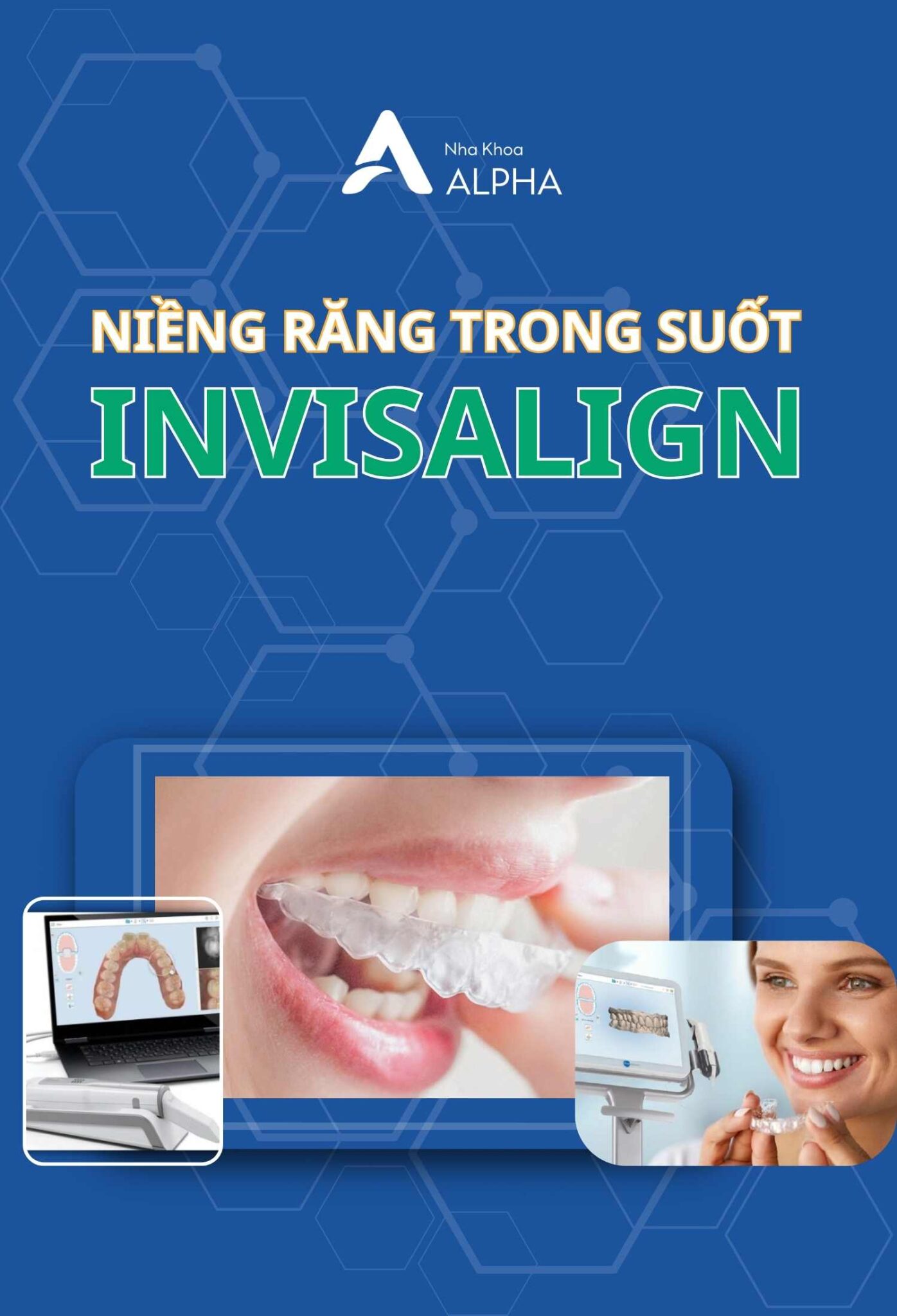 Phương pháp niềng răng invisalign Tại Nha Khoa Alpha